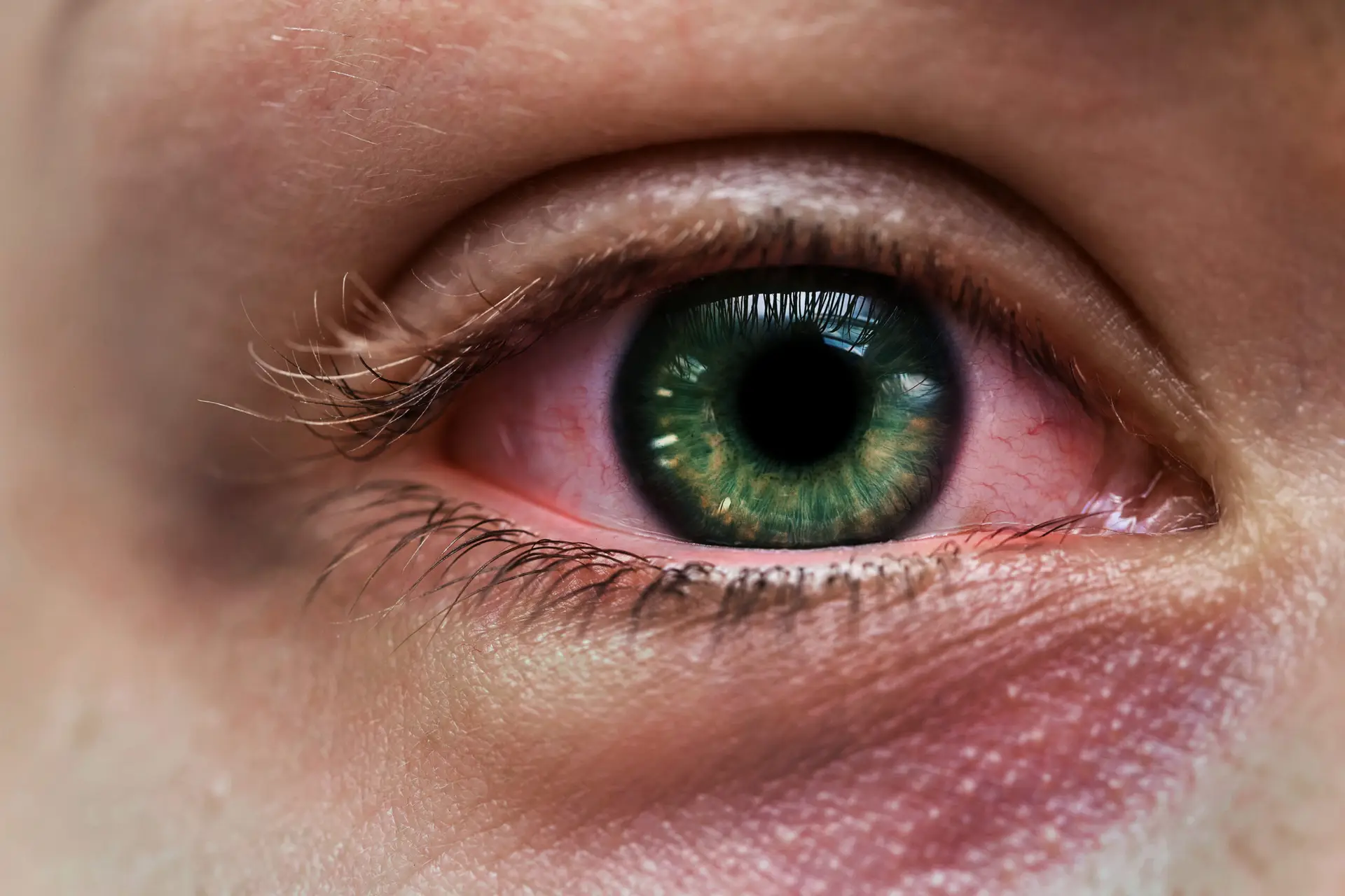 Opthalmology