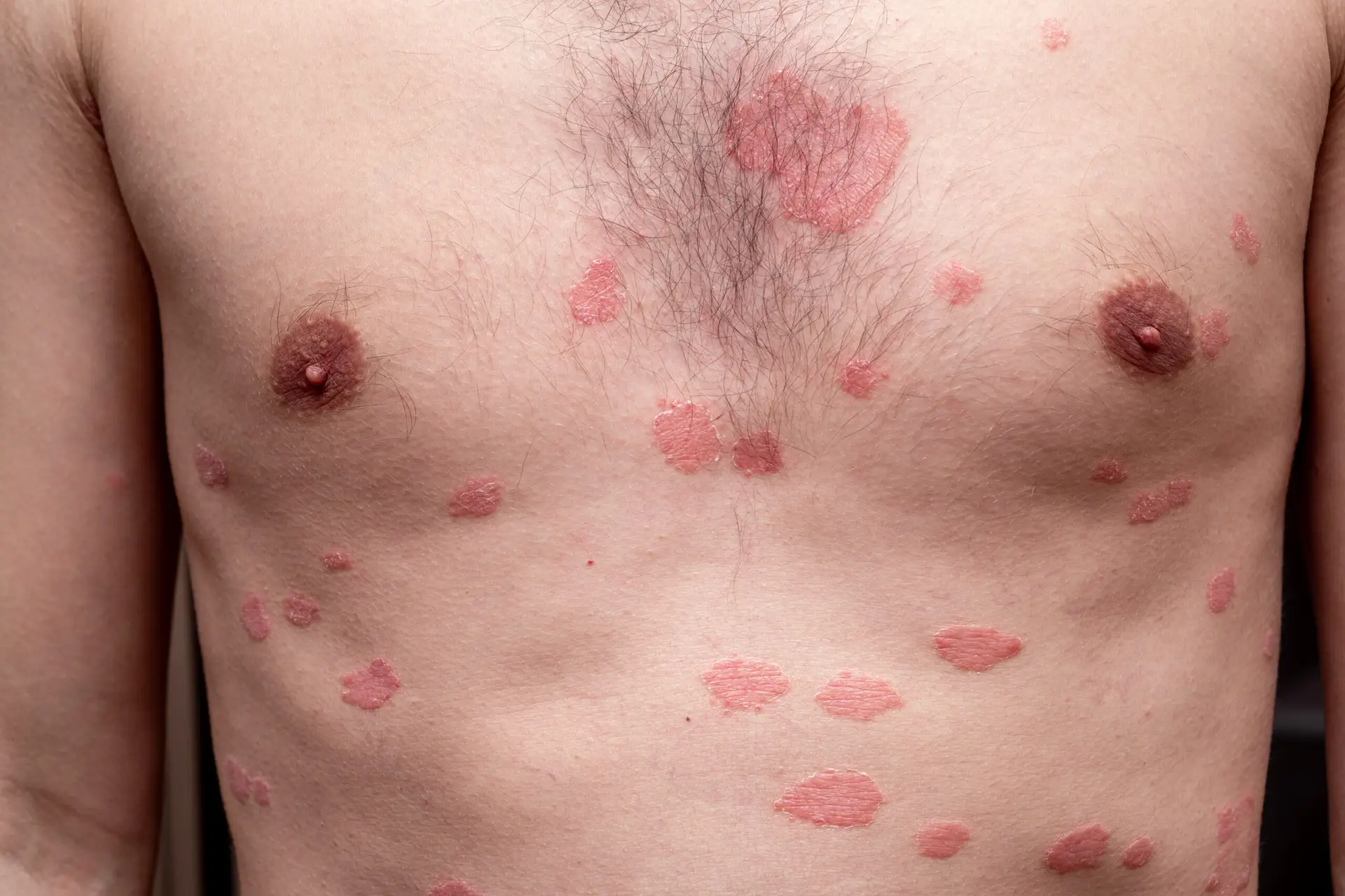Dermatology